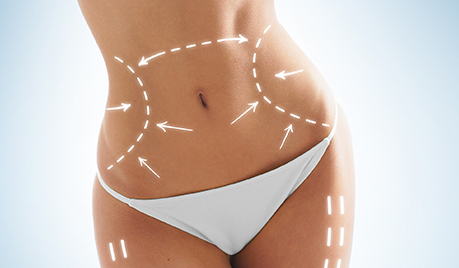 Ofertă lipoaspirație